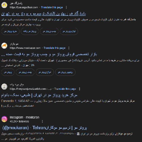 مرکز خرید پروتز مو در تهران