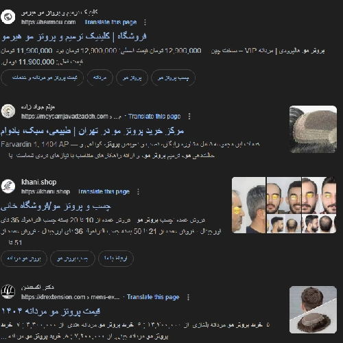 خرید پروتز مو